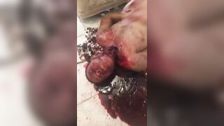Man Strangled With Rope And Stabbed In The Throat » Uncensored