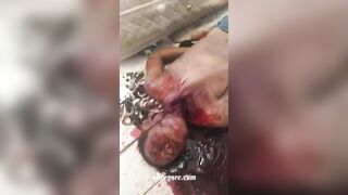 Man Strangled With Rope And Stabbed In The Throat » Uncensored