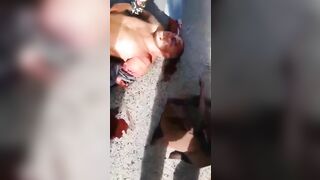 Man's Arm Torn Off In Accident » Uncensored Video