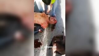 Man's Arm Torn Off In Accident » Uncensored Video
