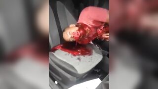 Man Shot In Car Convulses 
