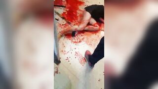 Man Attacks His Ex-girlfriend With Knife 