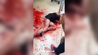Man Attacks His Ex-girlfriend With Knife 