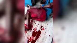 Guy Chopped To Pieces With Machete 