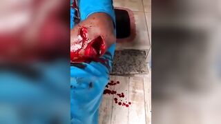 Guy Chopped To Pieces With Machete 