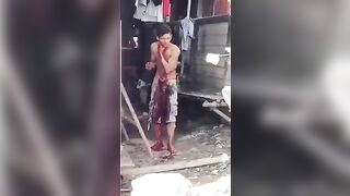 Guy Tries To Cut His Own Throat 
