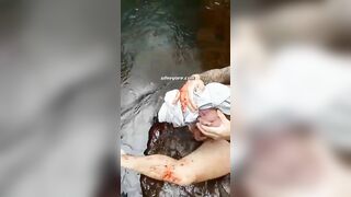 Man Climbs Waterfall And Loses Leg 