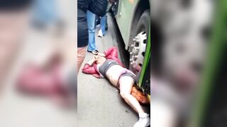 A Vehicle Traveled Over The Top Of A Woman’s Leg. Bogota, Columbia » Uncens
