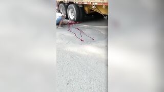Lower Body Of Human Body Crushed By Huge Trailer 