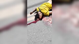 A Dead Motorcyclist With A Fractured Head And A Leaking Bra.