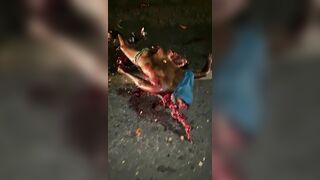 Motorcyclist's Body After Being Hit By Truck 