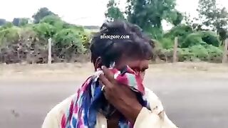 A Drunken Indian Motorcyclist With His Face Destroyed By A Lightning Strike.