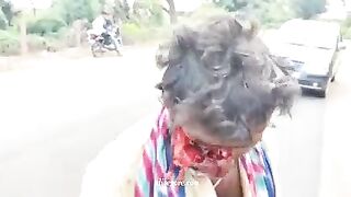 A Drunken Indian Motorcyclist With His Face Destroyed By A Lightning Strike.