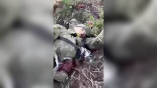 Russian Army Soldier's Leg Torn Off 