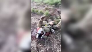 Russian Army Soldier's Leg Torn Off 