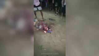 Street Justice. A Rapist's Skull Was Smashed With A Piece Of Wood