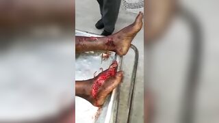 A Man Slashed His Wife's Ex-lover. Consequences » Uncensored