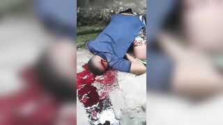 Two Brothers Were Shot In The Head. Brazil, Bahia State. 