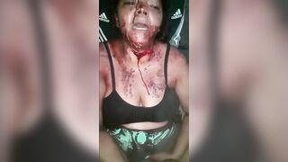 Woman Is Stunned As Husband Cuts Her Throat With A Loud Bang