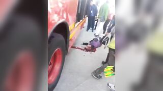 Pedestrian Hit Head-on By Bus