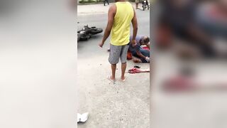 Lost Phone And Legs