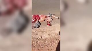 A Collection Of Several Gruesome Accidents In Which Bodies Were Torn 