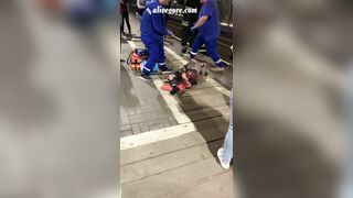 A Man Lost His Leg After Falling On The Subway Tracks. Russia, Male