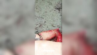 Thief's Arm Chopped Off With Machete 