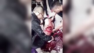 The Chinese Man's Wound Was Very Serious, His Front