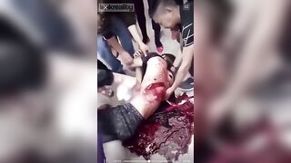 The Chinese Man's Wound Was Very Serious, His Front