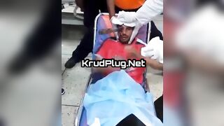 Doctor Pulls A Knife From A Man's Eye Socket