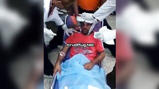 Doctor Pulls A Knife From A Man's Eye Socket