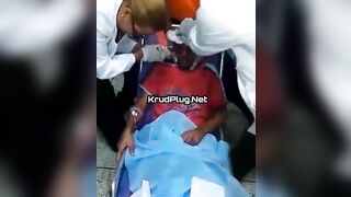 Doctor Pulls A Knife From A Man's Eye Socket