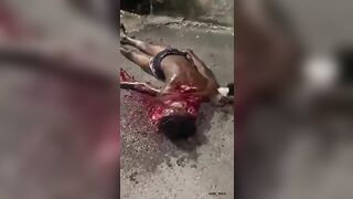 The Guy’s Face Was Turned Into A Bloody Mess By The Machete 