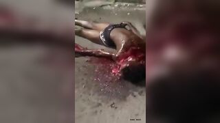 The Guy’s Face Was Turned Into A Bloody Mess By The Machete 