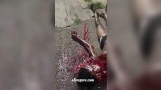 The Guy’s Face Was Turned Into A Bloody Mess By The Machete 