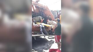 Garbage Truck Worker Subsequently Loses Legs