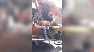 Garbage Truck Worker Subsequently Loses Legs