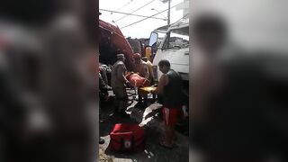 Garbage Truck Worker Subsequently Loses Legs