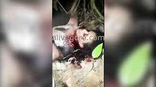 Girl Stabbed In Face