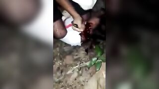 Girl Stabbed In Face