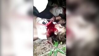 Girl Stabbed In Face