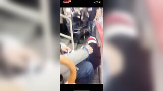 Hockey Fan Fell Down Stairs And Had His Head Smashed