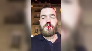 Journalist Beaten To Death By Antifa In Paris For Reporting