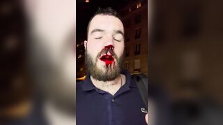 Journalist Beaten To Death By Antifa In Paris For Reporting