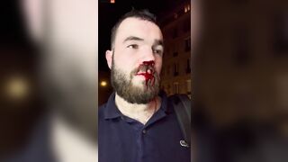 Journalist Beaten To Death By Antifa In Paris For Reporting