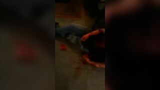 Man Stabbed In Violent Bar Brawl, Bleeding Like A Pig (full Video
