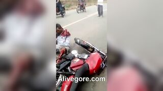 A Motorcyclist Lost His Arm On The Road. Mu