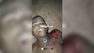 Shot In The Throat With A Shotgun. Bullets Fired From Sk