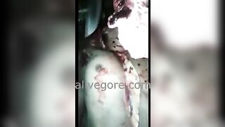 The Deceased's Liver And Eyes Were Removed. Video